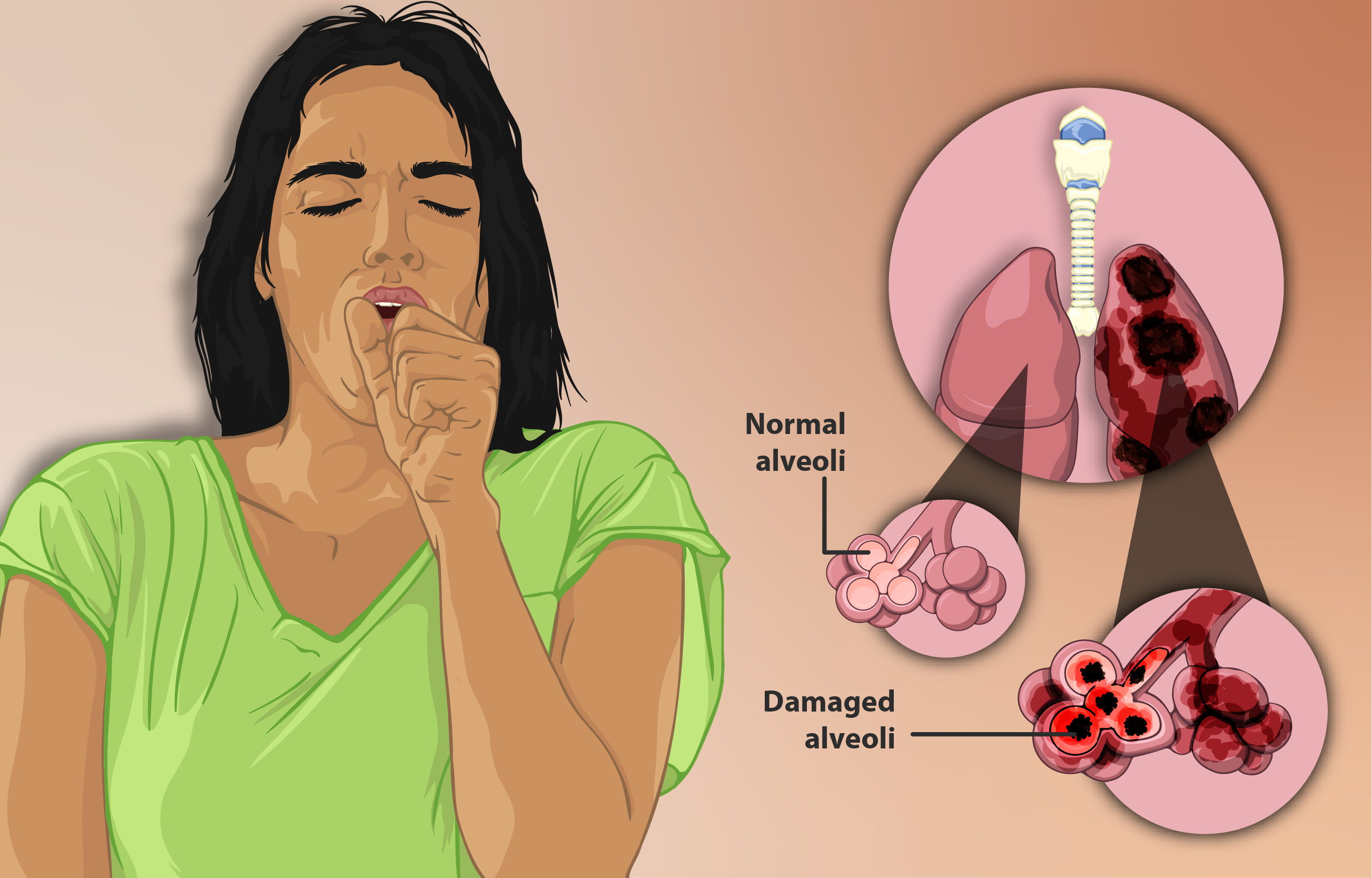 Depiction_of_a_woman_suffering_from_Emphysema,_a_type_of_Chronic_Obstructive_Pulmonary_Disease
